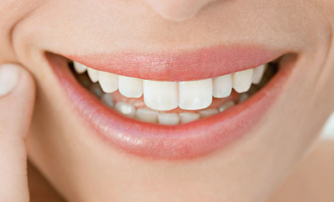 How to get a better smile in 2022 — teeth tweakments that will instantly make you look younger